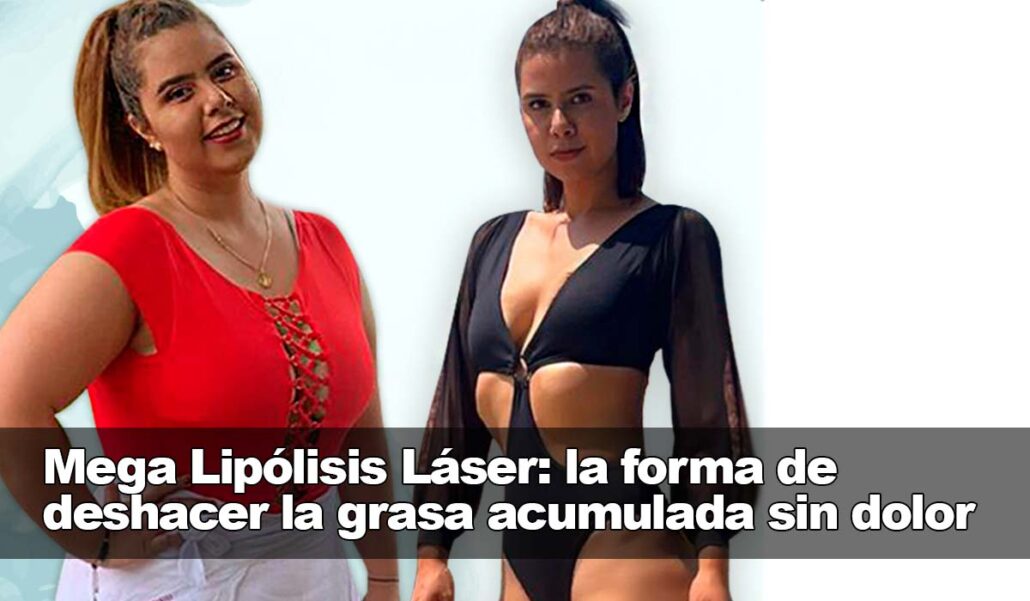 La Mega Lipólisis Láser: una forma segura de eliminar la grasa sin ningún dolor La Mega Lipólisis Láser: una forma segura de eliminar la grasa sin ningún dolor