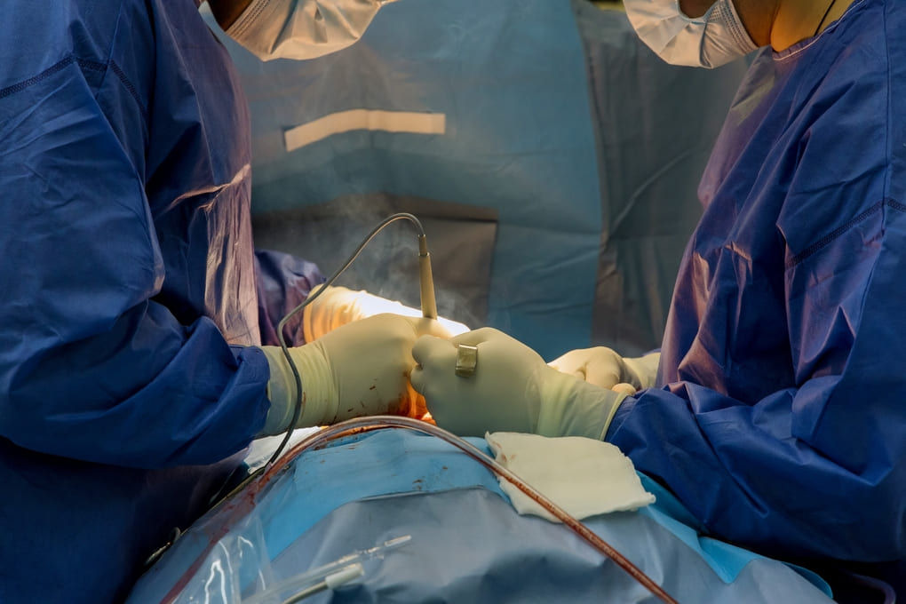 Mejora de la precisión en el manejo del estrés quirúrgico con ANI M Doloris en Panamá